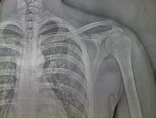 Фотография Seitan Дениса